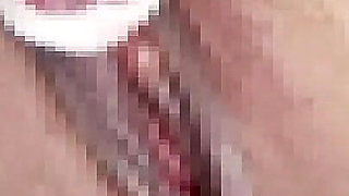 I Restrict the Clitoris That the M Woman Was Enlarged with a Thread and Let You Do the Consecutive Top