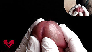 Glans Game with White Latex Gloves in Super-closeup