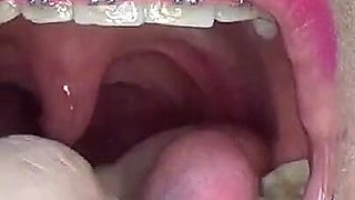 Swallowing Lots of Gummi Bears at Same Time!!