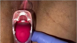 Pussy Care Gynecologist Speculum Examination Brought Me To Orgasm Fluid Examination