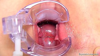 Chubby Teen 18+ Pussy Medical Fetish Porn Movie